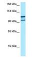MYO10 / Myosin-X Antibody - MYO10 / Myosin-X antibody Western Blot of 293T.  This image was taken for the unconjugated form of this product. Other forms have not been tested.