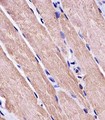 MYO18B / Myosin 18B Antibody - MYO18B Antibody staining MYO18B in human skeletal muscle tissue sections by Immunohistochemistry (IHC-P - paraformaldehyde-fixed, paraffin-embedded sections). Tissue was fixed with formaldehyde and blocked with 3% BSA for 0. 5 hour at room temperature; antigen retrieval was by heat mediation with a citrate buffer (pH6). Samples were incubated with primary antibody (1/25) for 1 hours at 37°C. A undiluted biotinylated goat polyvalent antibody was used as the secondary antibody.