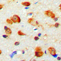 MYO1D Antibody - Immunohistochemical analysis of MYO1D staining in human brain formalin fixed paraffin embedded tissue section. The section was pre-treated using heat mediated antigen retrieval with sodium citrate buffer (pH 6.0). The section was then incubated with the antibody at room temperature and detected using an HRP conjugated compact polymer system. DAB was used as the chromogen. The section was then counterstained with hematoxylin and mounted with DPX.