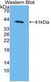 MYO5A / Myosin V Antibody - Western blot of recombinant MYO5A / Myosin V.