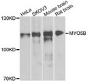 MYO5B / Myosin VB Antibody - Western blot analysis of extracts of various cells.