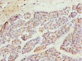 MYO5C Antibody - Immunohistochemistry of paraffin-embedded human pancreatic tissue at dilution 1:100