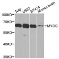 MYOC / Myocilin Antibody - Western blot analysis of extracts of various cell lines, using MYOC antibody at 1:1000 dilution. The secondary antibody used was an HRP Goat Anti-Rabbit IgG (H+L) at 1:10000 dilution. Lysates were loaded 25ug per lane and 3% nonfat dry milk in TBST was used for blocking. An ECL Kit was used for detection and the exposure time was 60s.