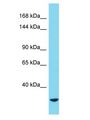 MYOM3 Antibody - MYOM3 antibody Western Blot of HepG2. Antibody dilution: 1 ug/ml.  This image was taken for the unconjugated form of this product. Other forms have not been tested.