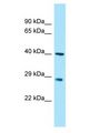 MYOZ3 Antibody - MYOZ3 antibody Western Blot of Fetal Kidney. Antibody dilution: 1 ug/ml.  This image was taken for the unconjugated form of this product. Other forms have not been tested.