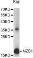 MZB1 Antibody - Western blot analysis of extracts of Raji cells, using MZB1 antibody at 1:1000 dilution. The secondary antibody used was an HRP Goat Anti-Rabbit IgG (H+L) at 1:10000 dilution. Lysates were loaded 25ug per lane and 3% nonfat dry milk in TBST was used for blocking. An ECL Kit was used for detection and the exposure time was 10s.