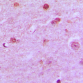 N4BP1 Antibody - Immunohistochemical analysis of N4BP1 staining in human brain formalin fixed paraffin embedded tissue section. The section was pre-treated using heat mediated antigen retrieval with sodium citrate buffer (pH 6.0). The section was then incubated with the antibody at room temperature and detected using an HRP conjugated compact polymer system. DAB was used as the chromogen. The section was then counterstained with hematoxylin and mounted with DPX.