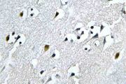 N4BP1 Antibody - IHC of N4BP1 (Y415) pAb in paraffin-embedded human brain tissue.