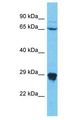 N4BP2L1 Antibody - N4BP2L1 antibody Western Blot of RPMI-8226. Antibody dilution: 1 ug/ml.  This image was taken for the unconjugated form of this product. Other forms have not been tested.