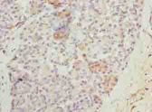 N4BP2L2 Antibody - Immunohistochemistry of paraffin-embedded human pancreatic tissue using antibody at dilution of 1:100.