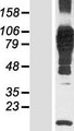 N4BP3 Protein - Western validation with an anti-DDK antibody * L: Control HEK293 lysate R: Over-expression lysate