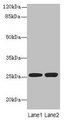 N6AMT2 Antibody - Western blot All lanes: N6AMT2 antibody at 10µg/ml Lane 1: Jurkat whole cell lysate Lane 2: K562 whole cell lysate Secondary Goat polyclonal to rabbit IgG at 1/10000 dilution Predicted band size: 24 kDa Observed band size: 24 kDa