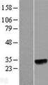 N6AMT2 Protein - Western validation with an anti-DDK antibody * L: Control HEK293 lysate R: Over-expression lysate