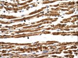 NAA16 / NARG1L Antibody - NAA16 / NARG1L antibody NARG1L(NMDA receptor regulated 1-like) Antibody was used in IHC to stain formalin-fixed, paraffin-embedded human muscle.  This image was taken for the unconjugated form of this product. Other forms have not been tested.