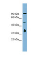 NAA35 Antibody - NAA35 / MAK10 antibody Western blot of OVCAR-3 cell lysate. This image was taken for the unconjugated form of this product. Other forms have not been tested.