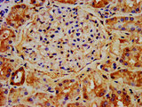 NAA38 / LSMD1 Antibody - IHC image of NAA38 Antibody diluted at 1:400 and staining in paraffin-embedded human kidney tissue performed on a Leica BondTM system. After dewaxing and hydration, antigen retrieval was mediated by high pressure in a citrate buffer (pH 6.0). Section was blocked with 10% normal goat serum 30min at RT. Then primary antibody (1% BSA) was incubated at 4°C overnight. The primary is detected by a biotinylated secondary antibody and visualized using an HRP conjugated SP system.