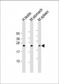 NAA40 Antibody - All lanes: Anti-NAA40 Antibody (C-Term) at 1:2000 dilution Lane 1: human testis lysate Lane 2: mouse stomach lysate Lane 3: mouse spleen lysate Lysates/proteins at 20 µg per lane. Secondary Goat Anti-Rabbit IgG, (H+L), Peroxidase conjugated at 1/10000 dilution. Predicted band size: 27 kDa Blocking/Dilution buffer: 5% NFDM/TBST.