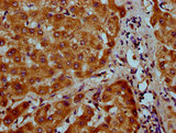 NAAA / ASAHL Antibody - Immunohistochemistry Dilution at 1:200 and staining in paraffin-embedded human liver tissue performed on a Leica BondTM system. After dewaxing and hydration, antigen retrieval was mediated by high pressure in a citrate buffer (pH 6.0). Section was blocked with 10% normal Goat serum 30min at RT. Then primary antibody (1% BSA) was incubated at 4°C overnight. The primary is detected by a biotinylated Secondary antibody and visualized using an HRP conjugated SP system.