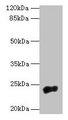 NACA2 Antibody - Western blot All lanes: NACA2 antibody at 5µg/ml + 293T whole cell lysate Secondary Goat polyclonal to rabbit IgG at 1/10000 dilution Predicted band size: 23 kDa Observed band size: 23 kDa