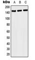 NACAD Antibody - Western blot analysis of NACAD expression in MCF7 (A); SP2/0 (B); H9C2 (C) whole cell lysates.
