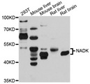 NADK / NAD Kinase Antibody - Western blot analysis of extracts of various cells.