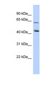 NADK2 / C5orf33 Antibody - C5orf33 antibody Western blot of HepG2 cell lysate. This image was taken for the unconjugated form of this product. Other forms have not been tested.