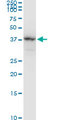NAGK Antibody - NAGK monoclonal antibody (M05), clone 1H8. Western blot of NAGK expression in Raw 264.7.