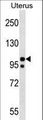 NALP4 / NLRP4 Antibody - NLRP4 Antibody western blot of Uterus tissue lysates (35 ug/lane). The NLRP4 antibody detected the NLRP4 protein (arrow).