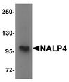 NALP4 / NLRP4 Antibody - Western blot analysis of NALP4 in K562 cell lysate with NALP4 antibody at 1 ug/ml.