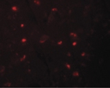 NALP6 / NLRP6 Antibody - Immunofluorescence of NALP6 in human brain tissue with NALP6 antibody at 20 ug/ml.