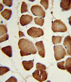 NAMPT / Visfatin Antibody - Formalin-fixed and paraffin-embedded human skeletal muscle reacted with NAMPT Antibody , which was peroxidase-conjugated to the secondary antibody, followed by DAB staining. This data demonstrates the use of this antibody for immunohistochemistry; clinical relevance has not been evaluated.