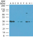 NAMPT / Visfatin Antibody - Western blot of NAMPT in human tumor cell lines at 1:1000. Lanes: A. HeLa, B. Jurkat, C. Daudi, D. HEK 293, E. Rh30, F. A375, G. T98G, H. HCT-116, I. Hep-2.