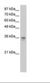 NANOG Antibody - HepG2 Cell Lysate.  This image was taken for the unconjugated form of this product. Other forms have not been tested.