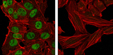 NANOG Antibody - Confocal immunofluorescence of NTERA-2 cells (left) and HeLa cells (right) using Nanog mouse monoclonal antibody (green). Red: Actin filaments have been labeled with DY-554 phalloidin.