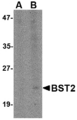 NANOS3 / NOS-3 Antibody - Western blot of Bst2 in Daudi cell lysate with Bst2 antibody at (A) 1 and (B) 2 ug/ml.