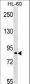 NAP1 / TAB3 Antibody - MAP3K7IP3 Antibody western blot of HL-60 cell line lysates (35 ug/lane). The MAP3K7IP3 antibody detected the MAP3K7IP3 protein (arrow).