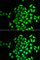 NAPG Antibody - Immunofluorescence analysis of U2OS cells.