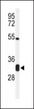 NAR / CPSF4 Antibody - Western blot of CPSF4 Antibody in Jurkat cell line lysates (35 ug/lane). CPSF4 (arrow) was detected using the purified antibody.