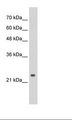 NAR / CPSF4 Antibody - Jurkat Cell Lysate.  This image was taken for the unconjugated form of this product. Other forms have not been tested.