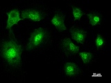 NARS Antibody - Immunostaining analysis in HT1080 cells. HT1080 cells were fixed with 4% paraformaldehyde and permeabilized with 0.1% Triton X-100 in PBS. The cells were immunostained with anti-NARS mAb.