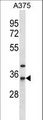 NAT1 / AAC1 Antibody - NAT1 Antibody western blot of A375 cell line lysates (35 ug/lane). The NAT1 antibody detected the NAT1 protein (arrow).