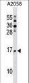 NAT5 / NAA20 Antibody - NAT5 Antibody western blot of A2058 cell line lysates (35 ug/lane). The NAT5 antibody detected the NAT5 protein (arrow).