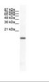 NATO3 / FERD3L Antibody - Jurkat Cell Lysate.  This image was taken for the unconjugated form of this product. Other forms have not been tested.