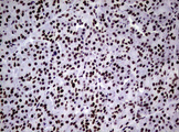 NBN / Nibrin Antibody - IHC of paraffin-embedded Human pancreas tissue using anti-NBN mouse monoclonal antibody.
