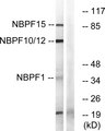 NBPF1+9+10+12+14+15+16+20 Antibody - Western blot analysis of lysates from 293, HepG2, Jurkat, and COLO cells, using NBPF1/9/10/12/14/15/16/20 Antibody. The lane on the right is blocked with the synthesized peptide.