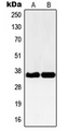 NBPF12 Antibody - Western blot analysis of NBPF-pan expression in Jurkat (A); HEK293 (B) whole cell lysates.