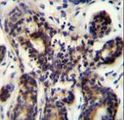 NBPF8 Antibody - NBPF8 Antibody immunohistochemistry of formalin-fixed and paraffin-embedded human breast tissue followed by peroxidase-conjugated secondary antibody and DAB staining.