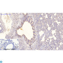 NBR1 Antibody - Immunohistochemical analysis of mouse lung tissue. Anti-NBR1 at 1:200 (4°C, overnight). Antigen retrieval - Sodium Citrate pH6 (>98°C, 20min). Secondary - 1:200 (room temp, 30min). Negative control - Secondary only