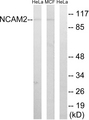 NCAM2 Antibody - Western blot analysis of lysates from MCF-7 and HeLa cells, using NCAM2 Antibody. The lane on the right is blocked with the synthesized peptide.