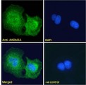 NCEH1 / AADACL1 Antibody - Goat Anti-AADACL1 Antibody Immunofluorescence analysis of paraformaldehyde fixed U2OS cells, permeabilized with 0.15% Triton. Primary incubation 1hr (10ug/ml) followed by Alexa Fluor 488 secondary antibody (2ug/ml), showing Endoplasmic reticulum staining. The nuclear stain is DAPI (blue). Negative control: Unimmunized goat IgG (10ug/ml) followed by Alexa Fluor 488 secondary antibody (2ug/ml).